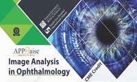 برگزاری وبینار تخصصی بین المللی با عنوان Image Analysis In Ophtalamogy
